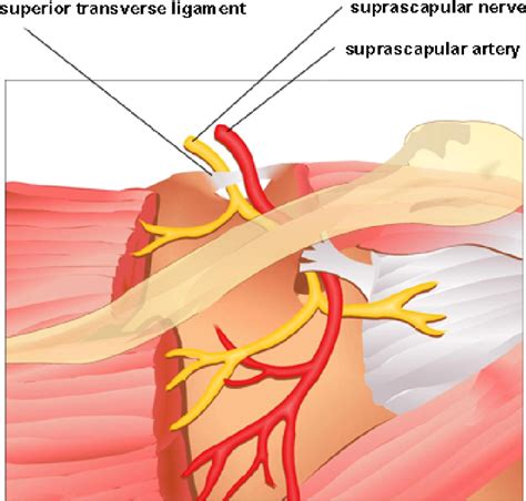 Arthroscopic Release of the Superior Transverse Ligament and SLAP Refixation in a Case of ...