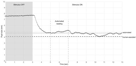 Reproducibility of Mesopic and Photopic Pupil Sizes in Myopic Children ...