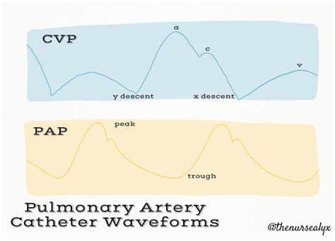 Image result for How Would You Draw SvO2 Form Pulmonary Artery Line