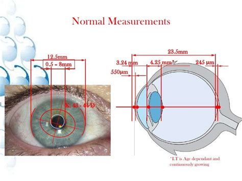 Image result for Occular Biometry