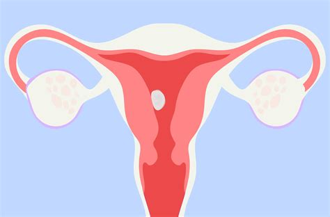 Miscarriage vs. Period: How to Tell If It's a Miscarriage?