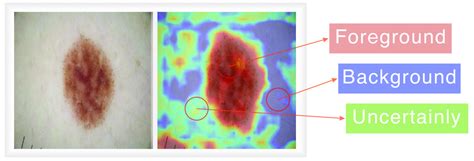 Image result for Image Segmentation Using Unsupervised Learning