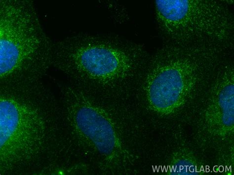 YKT6 antibody (33685-1-AP) | Proteintech