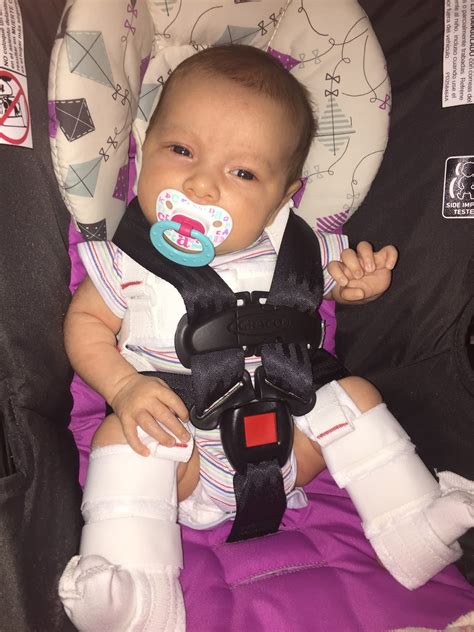 Lily's E'Claires: Camille's Hip Dysplasia ~ Life with a Pavlik Harness