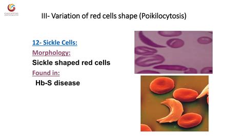 Abnormal morphology of rbc notes | PDF