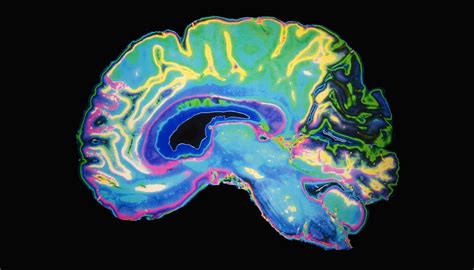 Brain Scans Suggest Drums And Bass Change How The Brain Hears Pop Music, New Study Finds