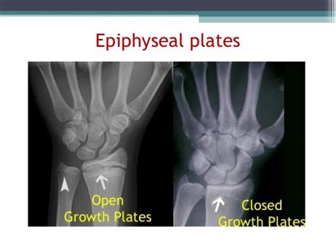 Image result for Appendix with Screen Shot Example