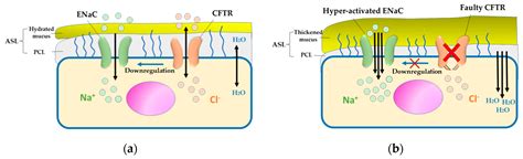 Cystic Fibrosis: Overview of the Current Development Trends and ...