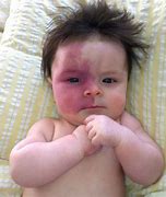 Image result for malformations