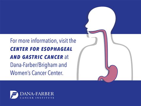 Esophageal Cancer Signs & Symptoms | Dana-Farber Cancer Institute