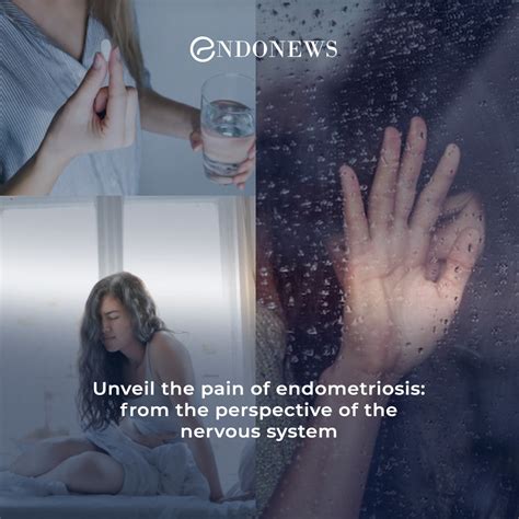 Endometriosis and the possible mechanisms of pain. | EndoNews