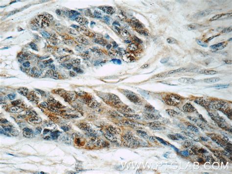 PBK/SPK antibody (16110-1-AP) | Proteintech