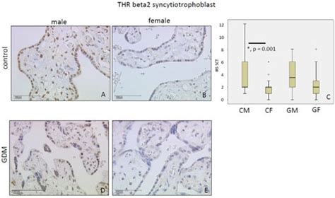 Cell Type- and Sex-Specific Dysregulation of Thyroid Hormone Receptors ...