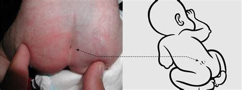 Image result for Distribution Line Graph