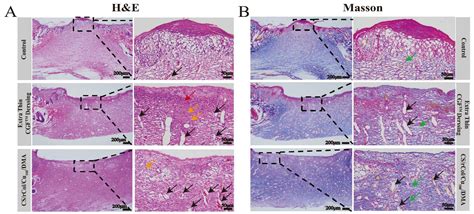 Biological Macromolecule Hydrogel Based on Recombinant Type I Collagen ...