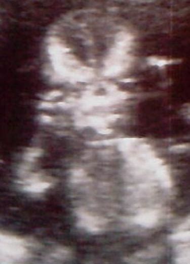 Image result for Alien Ultrasound