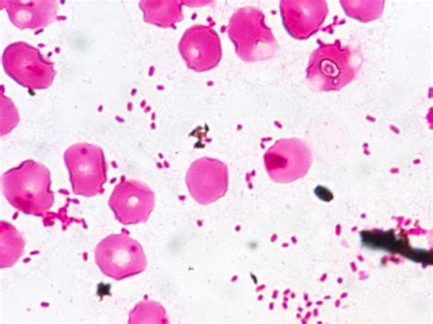 Haemophilus influenzae〔インフルエンザ桿菌〕 | グラム染色: Gram Stain