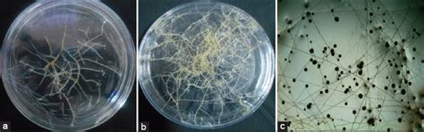 Accumulation of cadmium in maize roots inoculated with root organ ...