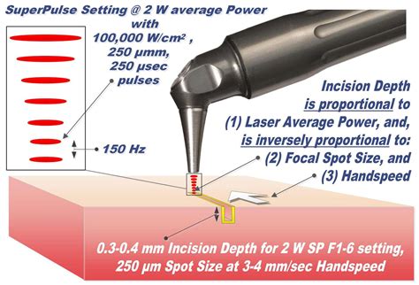 Laser Surgery Basics - American Laser Study Club
