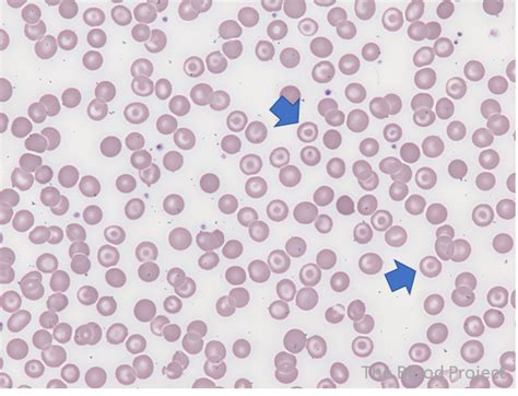 Image result for Target Cells