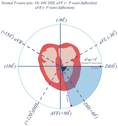 Recovery from Severe COVID-19 Is an Independent Predictor of ...