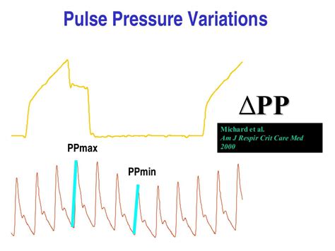 Pulse Pressure Variations