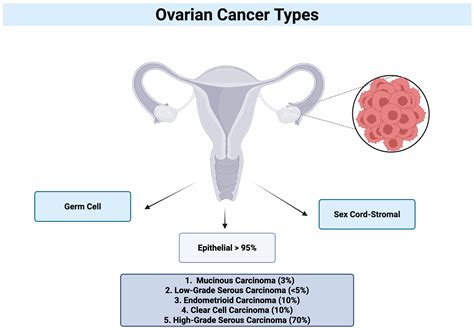Decoding the Link Between Talcum Powder and Ovarian Cancer: A ...