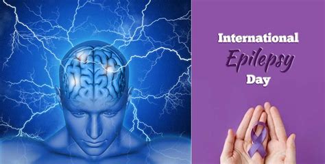 International Epilepsy Day : एखाद्याला अपस्माराचा झटका आल्यास नक्की काय ...