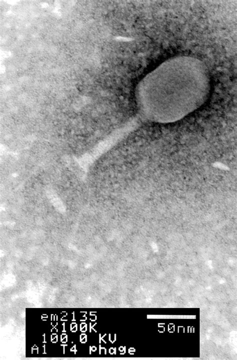 Enterobacteria phage T4 (Phage tail fibers) - CIL:41130 - DocCheck