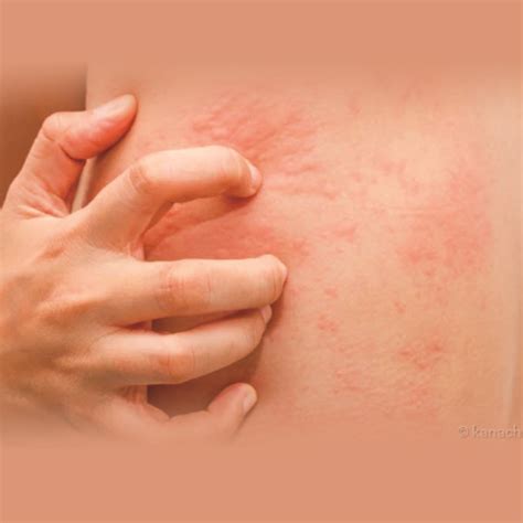 Dermaplus - Services