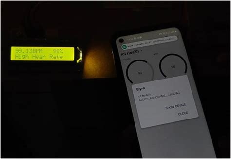 IoT Based Advanced Cardiac Arrest Detection System