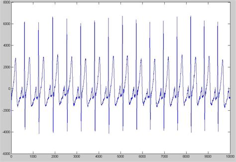 Image result for MATLAB Filter Function