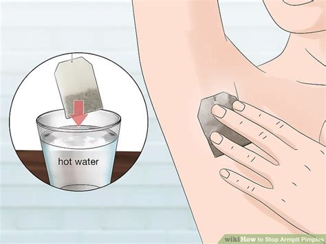 Exploding Armpit Zits 的图像结果