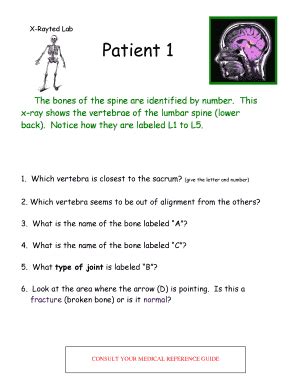 Medical X-Ray Analysis Form - Blank Fillable Template | Fill Out, Print ...
