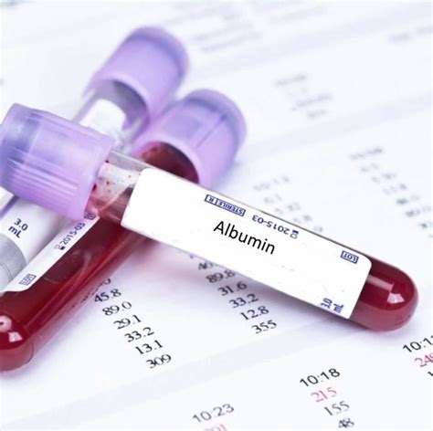 Albumin function, albumin levels and causes of high or low albumin levels