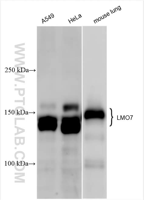 LMO7 antibody (29392-1-AP) | Proteintech