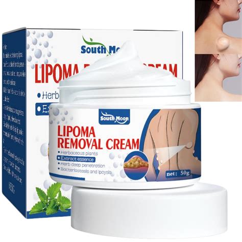 Lipoma Removal Cream