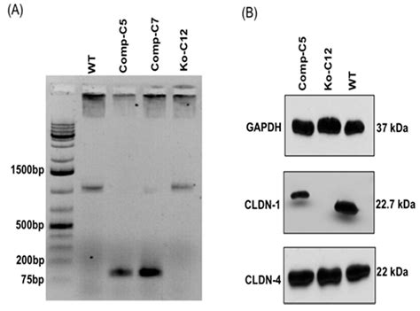 Effects of Claudin-1 on the Action of Clostridium perfringens ...