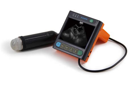 Cheap Portable Ultrasound Machine For Pregnancy at Jonathan Stiefel blog