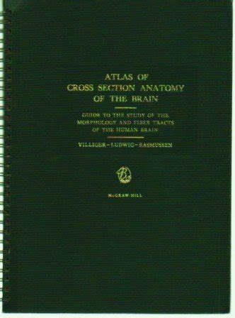 Buy Atlas of cross section anatomy of the brain: Guide to the study of ...