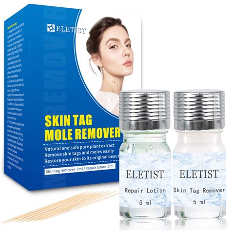 ELETIST Skin Tag Remover Set - Quick and Easy India | Ubuy