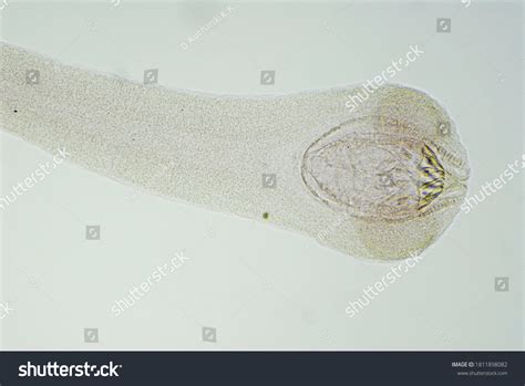 481 Tapeworm Scolex Images, Stock Photos & Vectors | Shutterstock