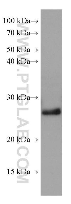 HSP27 antibody (66767-1-Ig) | Proteintech