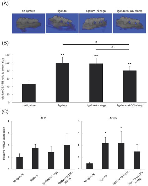 Cationic Glucan Dendrimer Gel-Mediated Local Delivery of Anti-OC-STAMP ...