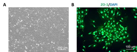 Image result for Small Intestine Epithelial Cells