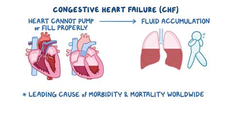 Video: Congestive heart failure: Clinical sciences | Osmosis