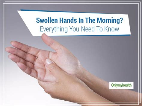 Wave Goodbye To Swollen Hands In The Morning By Learning Its Causes And ...