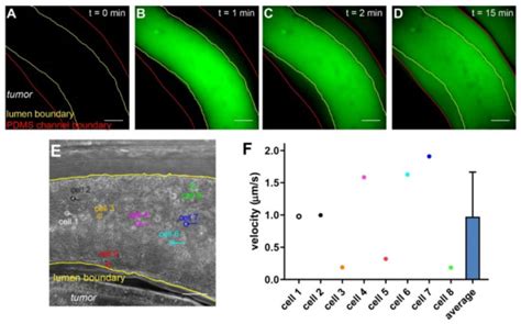 Engineering a Vascularized Hypoxic Tumor Model for Therapeutic Assessment