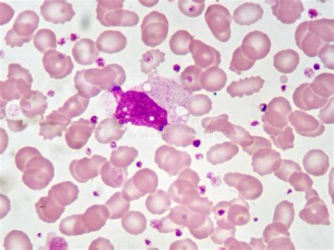 Image result for Monocyte Electron Microscope