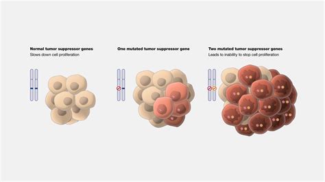 Tumor Suppressor Gene